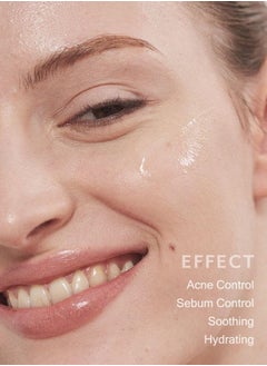 MIZON GOOD BYE BLEMISH SOOTHING GEL CREAM 55ml Korean skincare  Soothing gel cream Acne treatment Prevention of acne breakouts Suitable for sensitive skin  - Image 5