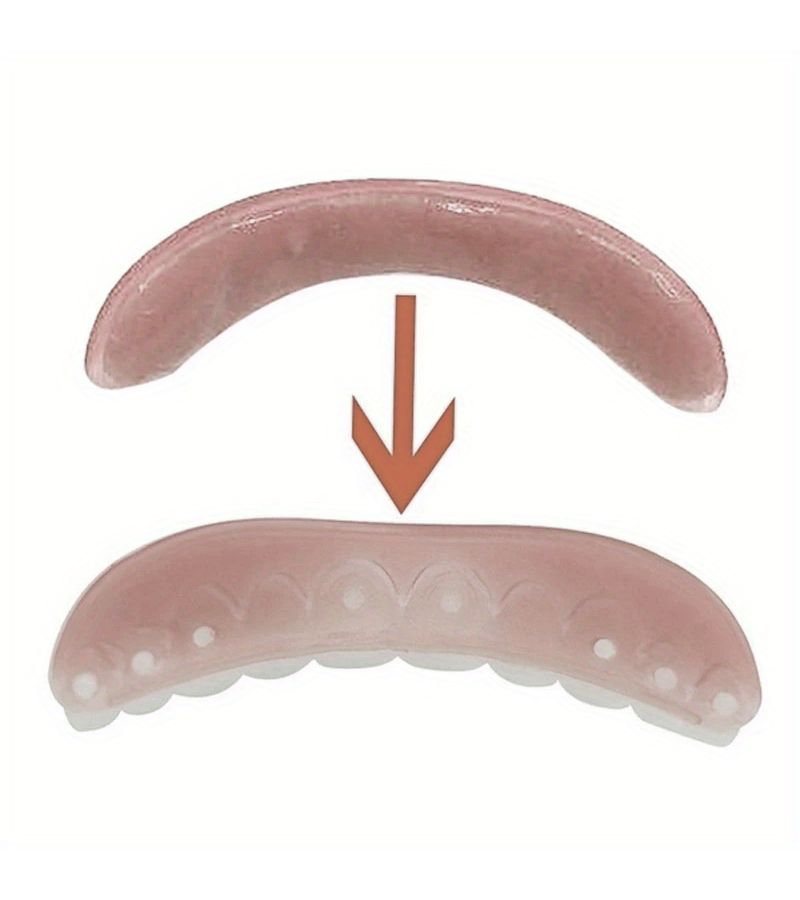 2Pcs Dentures Accessory for Missing Teeth Large Cracks Easy Use - Image 3