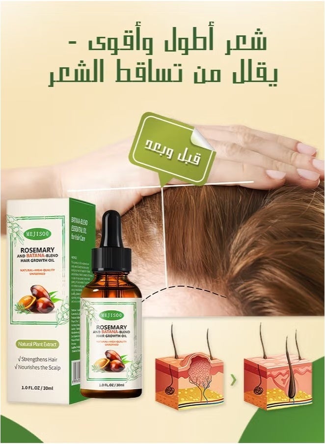 ميجيسو زيت إكليل الجبل وباتانا لنمو الشعر – علاج لفروة الرأس، يعزز كثافة الشعر ويصلح التلف والجفاف، 30مل - Image 3