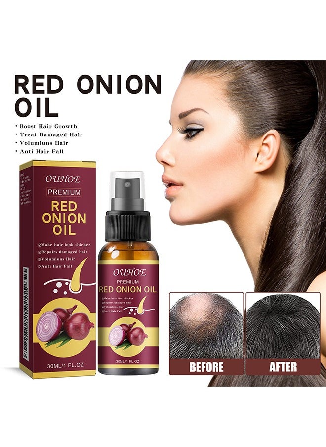 OUHOE - Premium Red Onion Oil，Hair Oil with , Red Onion Extraxt, Castor Oil and Coconut Oil- Organic Formula for Hair Growth and Hair Loss Control 30ML - Image 1