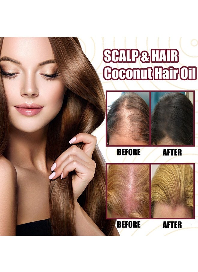 OUHOE - Premium Red Onion Oil，Hair Oil with , Red Onion Extraxt, Castor Oil and Coconut Oil- Organic Formula for Hair Growth and Hair Loss Control 30ML - Image 1