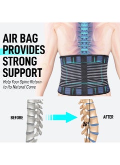 FEATOL Inflatable waist belt, pressure relief brace, back support belt back brace waist pressure relief belt for pain relief and injury prevention for men and women sciatica, spinal stenosis, scoliosis or herniated disc  - Image 2