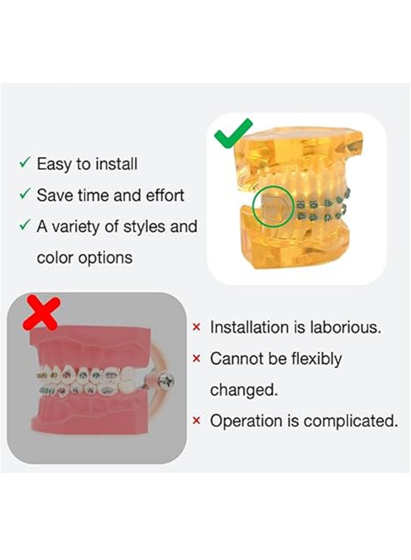Apustim Tooth Decoration，Including Metal Wire，Metal Bracket And Correction Ligature，Is a Prop For Orthodontists To Explain And a Prop For Dental Students To Practice （Dark Blue + Cyan）  - Image 4
