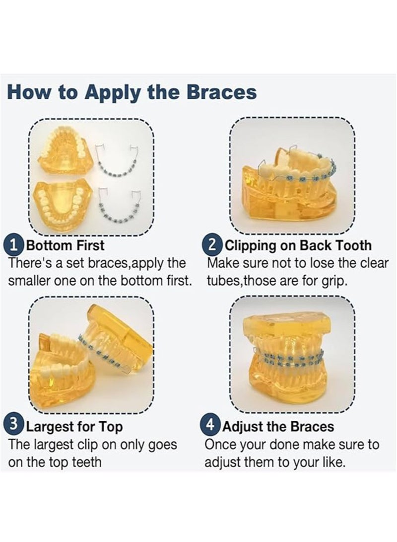 Apustim Tooth Decoration，Including Metal Wire，Metal Bracket And Correction Ligature，Is a Prop For Orthodontists To Explain And a Prop For Dental Students To Practice （Dark Blue + Cyan）  - Image 2
