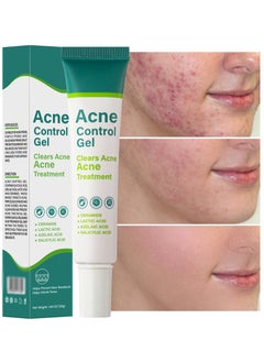MOOYAM Acne Treatment Cream,Acne Spot Treatment gel,Clear Acne Spot Treatment Gel,Pimple Cream for Acne Prone Skin Care,Acne Control Gel,Salicylic Acid Acne Treatment Gel,Clear Breakouts, 30g  - Image 1
