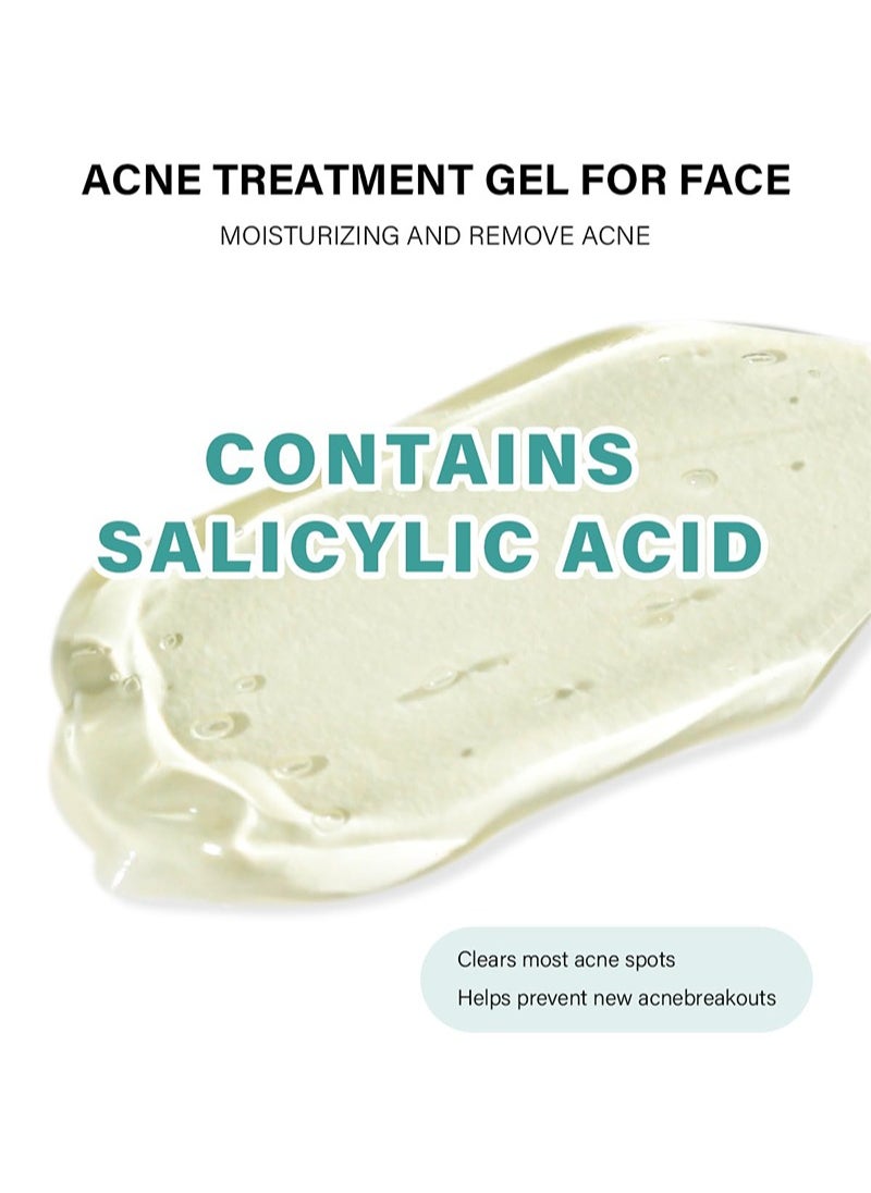 MOOYAM Acne Treatment Cream,Acne Spot Treatment gel,Clear Acne Spot Treatment Gel,Pimple Cream for Acne Prone Skin Care,Acne Control Gel,Salicylic Acid Acne Treatment Gel,Clear Breakouts, 30g  - Image 2