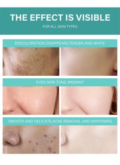 MOOYAM Acne Treatment Cream,Acne Spot Treatment gel,Clear Acne Spot Treatment Gel,Pimple Cream for Acne Prone Skin Care,Acne Control Gel,Salicylic Acid Acne Treatment Gel,Clear Breakouts, 30g  - Image 4