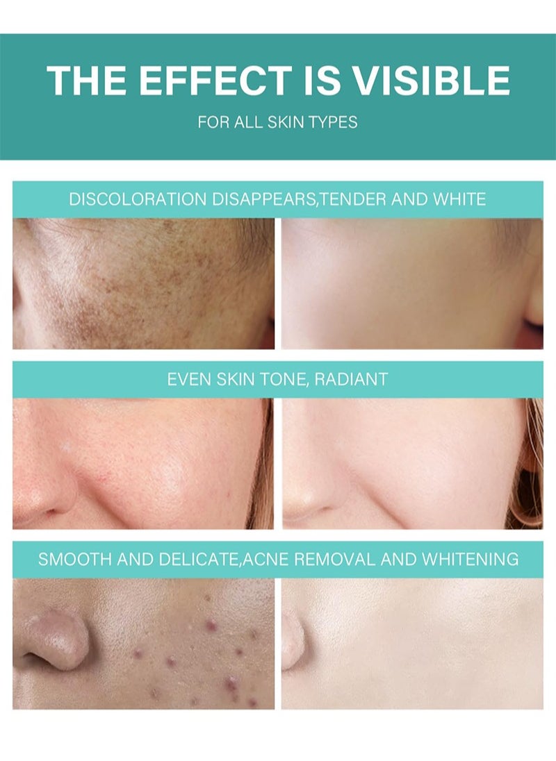 MOOYAM Acne Treatment Cream,Acne Spot Treatment gel,Clear Acne Spot Treatment Gel,Pimple Cream for Acne Prone Skin Care,Acne Control Gel,Salicylic Acid Acne Treatment Gel,Clear Breakouts, 30g  - Image 4