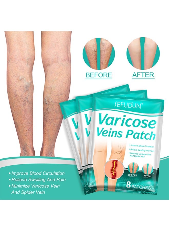 Sefudun - 16 PCS Varicose Veins Patch, Varicose Veins Treatment For Legs, Spider Varicose Vein, Strengthen Capillary Health and Improve Blood Circulation, Improves Blood Circulation, Relieves Leg Fatigue - Image 1
