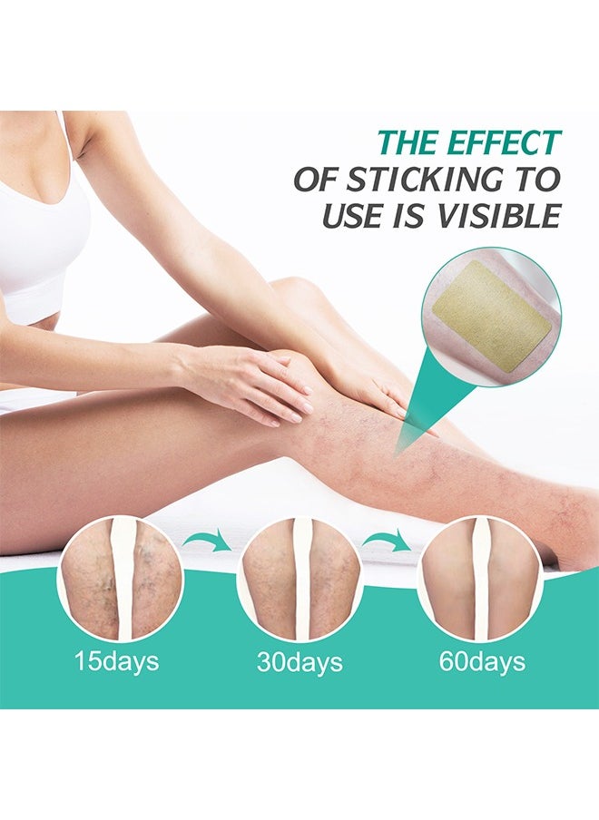 Sefudun - 16 PCS Varicose Veins Patch, Varicose Veins Treatment For Legs, Spider Varicose Vein, Strengthen Capillary Health and Improve Blood Circulation, Improves Blood Circulation, Relieves Leg Fatigue - Image 1