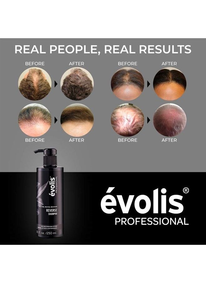 evolis - évolis REVERSE Shampoo - Hair Growth Shampoo - Keratin Shampoo Sulfate Free - Natural Hair Growth Shampoo with Keratin and Wheat Protein - Hair Growth Treatment (8.5 fl oz) - Image 1