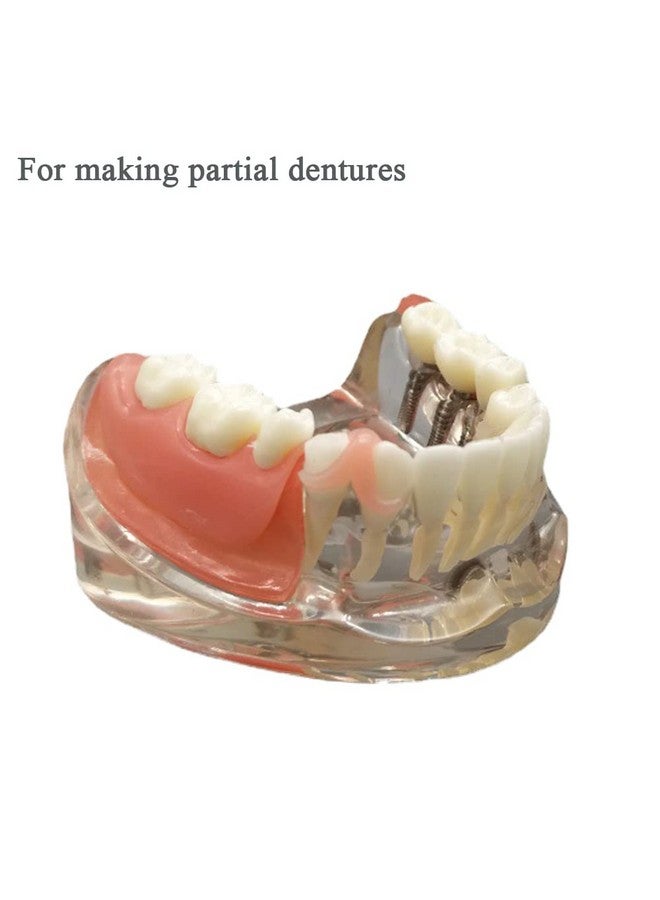 Generic Gum Material For Diy Denture Improve Smile, Tooth Repair Kit, Teeth Fitting Material  - Image 2
