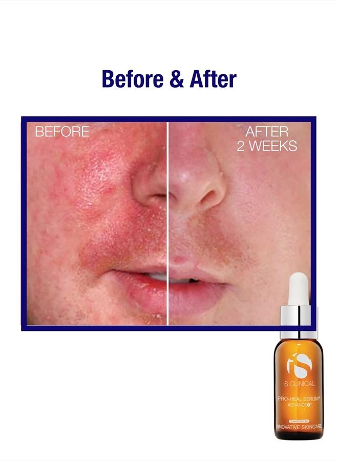 iS CLINICAL Pro-Heal Serum Advance+ Antioxidant-rich Vitamin C Serum, Vitamin E And Retinol For Redness, Rosacea And Inflammation - Image 5
