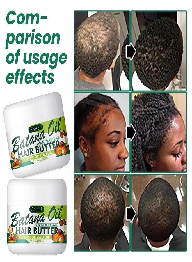 Brzeaf Natural Raw Batana Oil for Women & Men Hair Growth, 3.5 Fluid Ounces - Hair Treatment Oils for All Hair Types, Moisturizing and Nourishing Hair Oil - Image 5