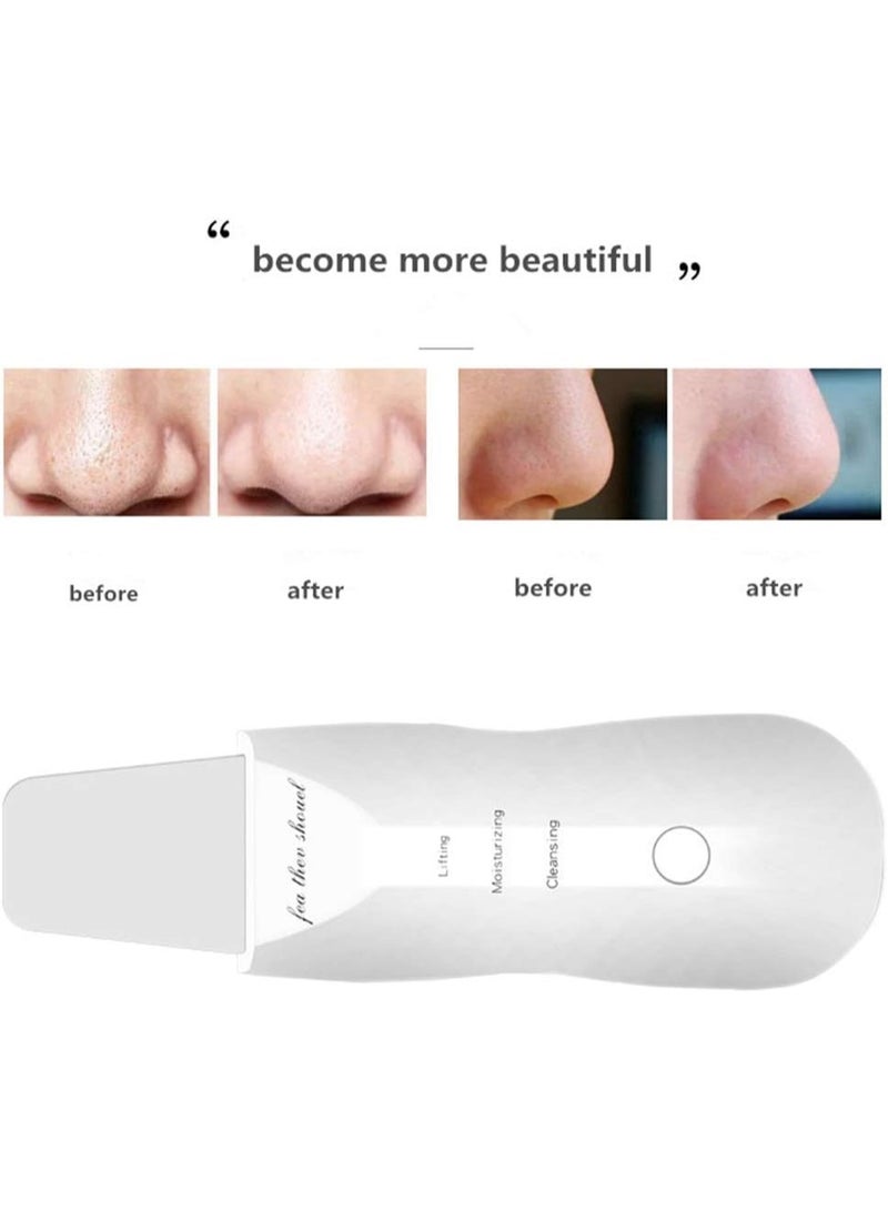 جهاز تقشير البشرة بالموجات فوق الصوتية للوجه – منظف مسام عميق، مكشطة للوجه، مضاد للتجاعيد وعلامات التقدم بالعمر، تصميم آمن بدون شفرات، يزيل الرؤوس السوداء، يقلل الخطوط الدقيقة، ينعم ويطرّي البشرة، جهاز علاج يومي للوجه، عناية منزلية بجودة السبا - Image 4