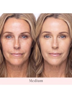 Mally Beauty Stress Less Performance Concealer - Medium - Buildable Coverage - Formulated with Niacinamide - Brightens and Hydrates - Covers Redness and Blemishes  - Image 2