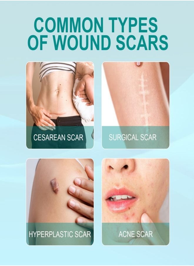 SOUTH MOON - Medical Grade Scar Spray for Reduce Scars and Smooth Skin - Image 1