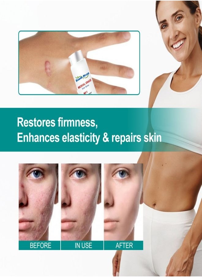 SOUTH MOON - Medical Grade Scar Spray for Reduce Scars and Smooth Skin - Image 1