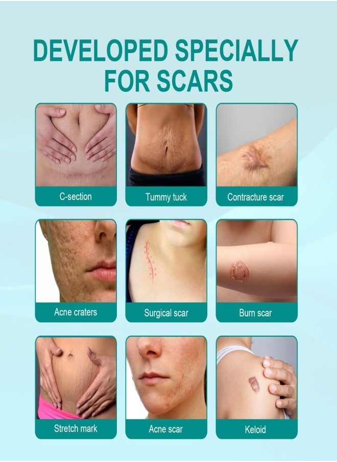 SOUTH MOON - Medical Grade Scar Spray for Reduce Scars and Smooth Skin - Image 1