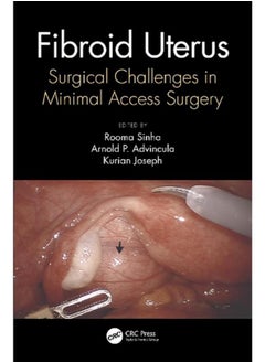 Fibroid Uterus: Surgical Challenges in Minimal Access Surgery 