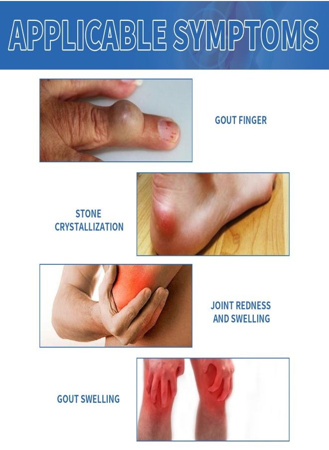 SOUTH MOON - Pain Relief Cream，Healing Ointment for Gout, Gout Pain Relief Ointment Toe Joint Valgus Corrector Cream, Bunion Toe Stiffness Relief Cream, Gout and You Pain Relief Cream - Image 1
