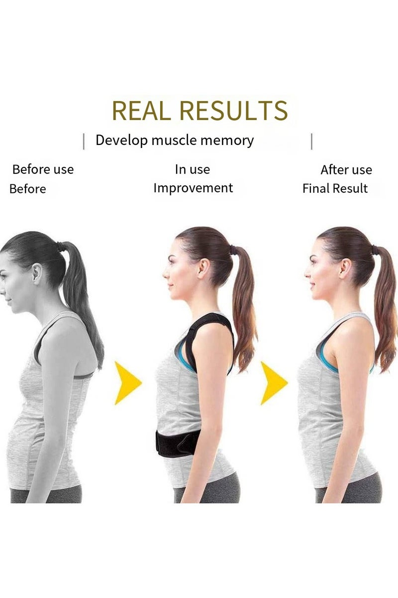 general Back Posture Corrector for Men & Women – Adjustable Orthopedic Back Brace for Spine Alignment & Shoulder Support – Posture Trainer Straightener Belt for Upper & Lower Back Relief - Image 3