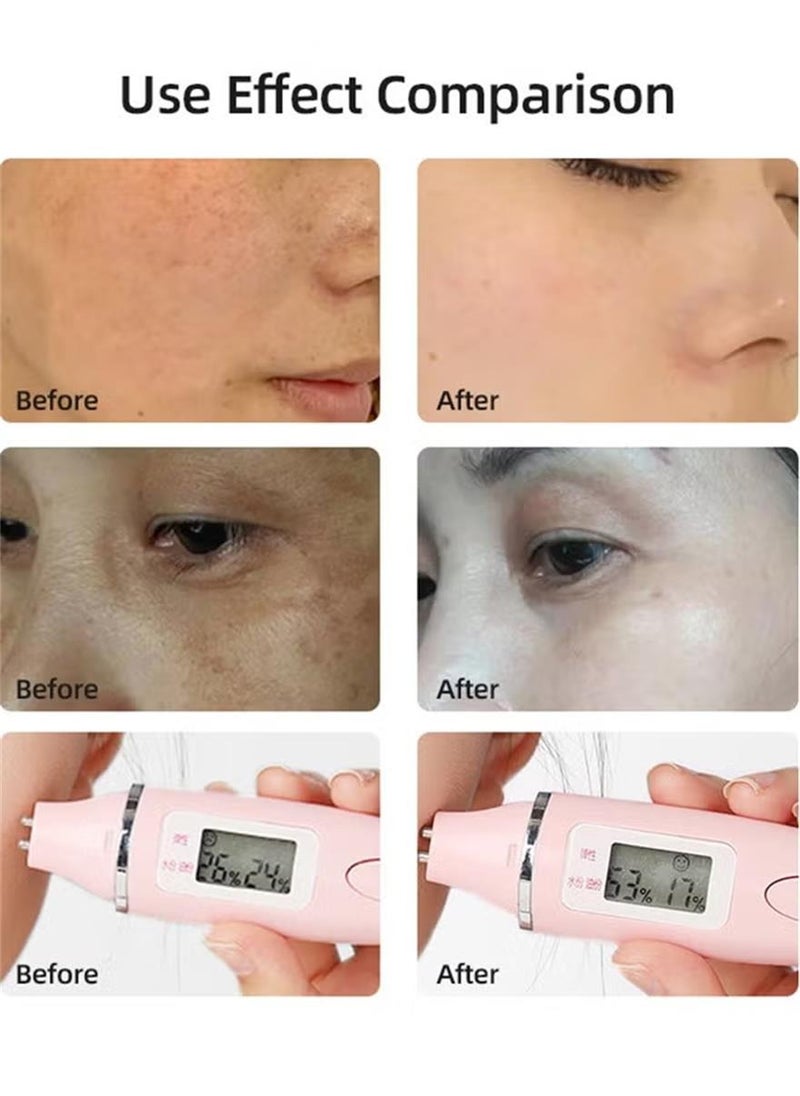 Timeless - Skin Care 20% Vitamin C + E Ferulic Acid Serum - 30ML - Lightweight, Non-Greasy Formula - Use Daily to Brighten, Restore & Correct Skin - Recommended for All Skin Types - Image 1