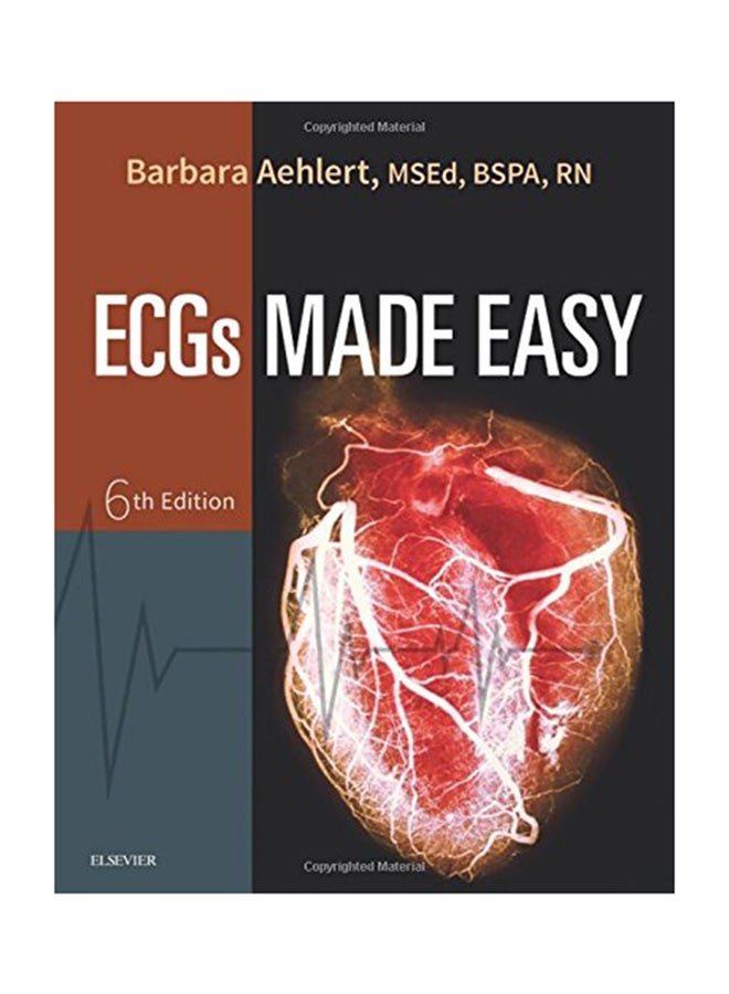 ECGs Made Easy