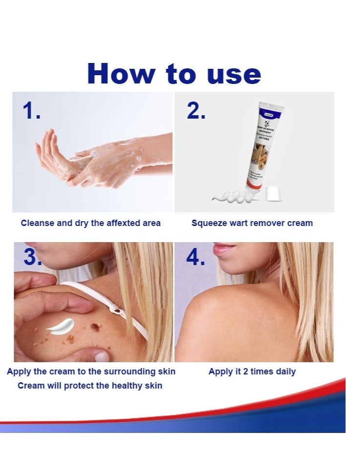 KanyeHB كريم إزالة الثآليل، مزيل الثآليل للثآليل التناسلية، الثآليل الأخمصية، الثآليل الشائعة، المسامير، كريم الثآليل 20 جرام - Image 4