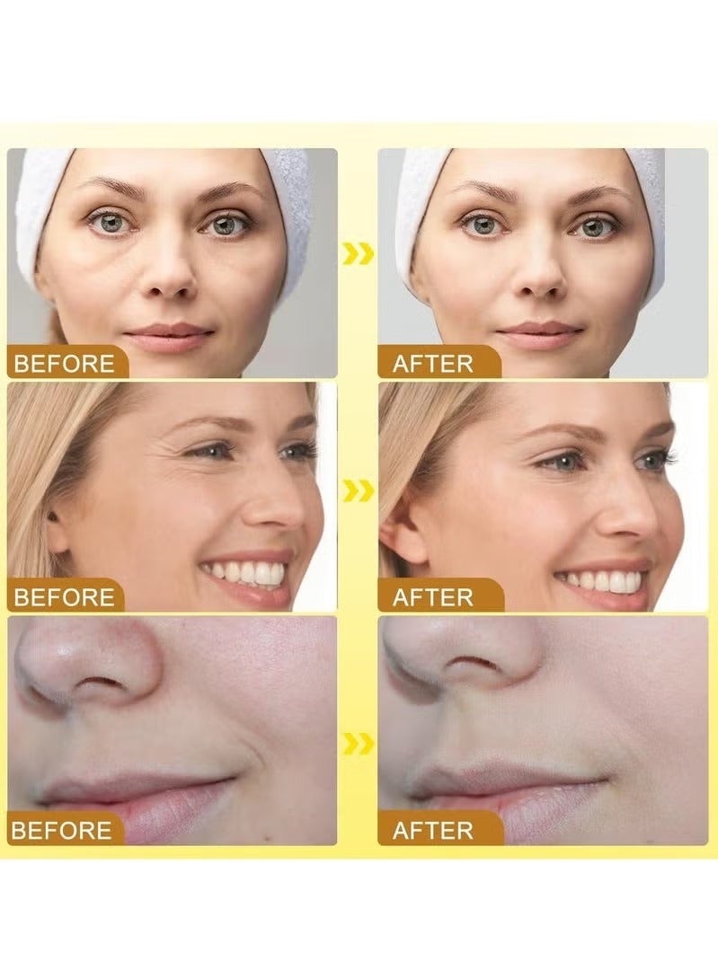 OUHOE 3Pcs Botox Bee Venom Cream Wrinkle Removal & Firming,Moisturizing,Lifting & Recovery for All Skin Type,Anti-Aging Bee Venom Cream,Face Cream Moisturiser - Image 5
