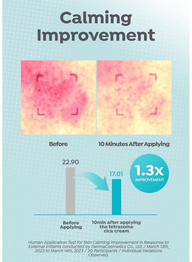 إيه بيو كريم Madecassoside Tetrasome Cica 1.69 أونصة سائلة/ 50 مل، امتصاص محسّن، حاجز جلدي معزز، تأثيرات مهدئة، كينتيللا اسياتيكا، حمض آسياتيكوسايد - Image 5