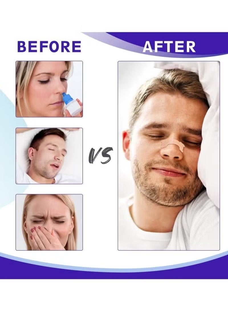 Sefudun Nasal Strips, Breathe Nose Strips to Reduce Snoring and Relieve Nose Congestion Works Instantly to Improve Sleep, Relieve Nasal Congestion Due to Colds & Allergy, 11.5*2.5*15.3 cm(30Pcs)  - Image 3