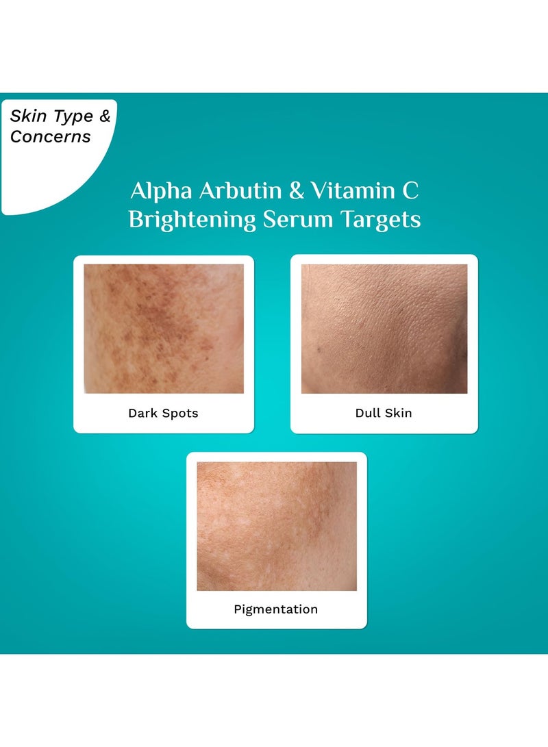 PILGRIM Korean Alpha Arbutin 2 Percent Vitamin C 3 Percent Brightening Face Serum Glowing Skin All Skin Types Men Women Vegan Cruelty Free 30ml - Image 5