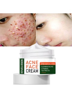 MOOYAM Acne Treatment Face Cream, Acne Spot Treatment for Face & Acne Dots, Natural Cystic Acne Treatment, For All Skin Types, Premium Acne Scar Cream & Pimple Remover - 30ML  - Image 3