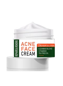MOOYAM Acne Treatment Face Cream, Acne Spot Treatment for Face & Acne Dots, Natural Cystic Acne Treatment, For All Skin Types, Premium Acne Scar Cream & Pimple Remover - 30ML  - Image 2