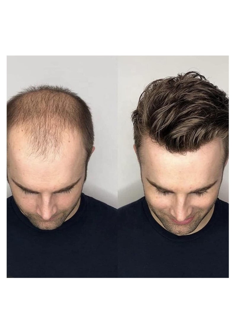 Estelle - Australian Hair Patch for Men, 100% Human Hair, Natural Looking Thin Front Lace Hair black - Image 1
