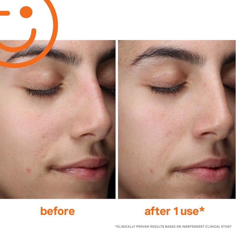 Kate Somerville ExfoliKate Cleanser â€“ Daily Exfoliating Foaming Face Wash, Clinically Formulated Glycolic Acid and Lactic Acid Gentle Facial Scrub, Travel-Size, 1.7 Fl Oz - Image 5