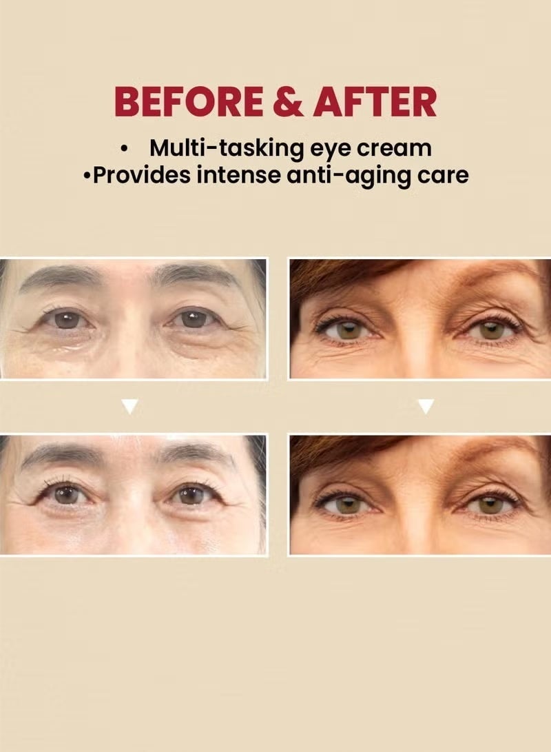 SEOUL1988 SEOUL 1988 Eye Cream : Retinal Liposome 4% + Fermented Bean 30ml - Image 3