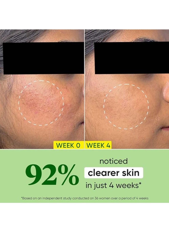 Dot & Key - Cica + Niacinamide Oil-Free Face Moisturizer For Calm, Acne Free Hydrated Skin Fades Acne Scars & Dark Spots, Soothes Redness & Irritation | For Oily, Acne Prone & Sensitive Skin | 60Ml Jar - Image 1