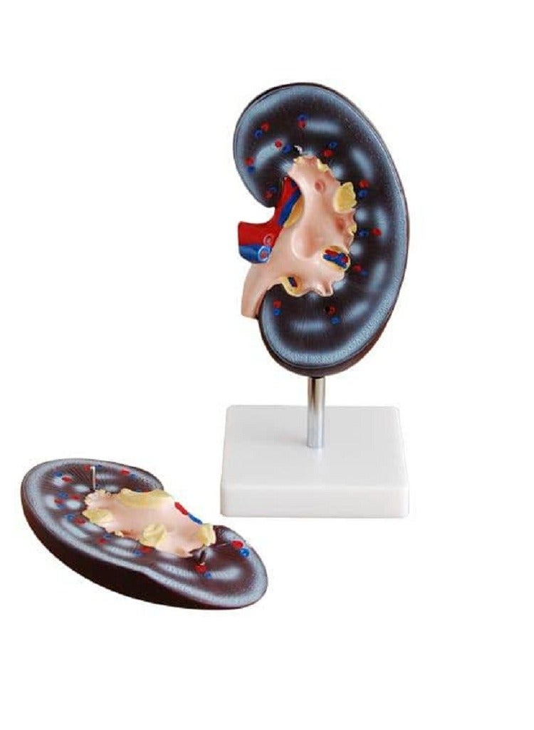 AKM meticulously detailed anatomical kidney model. Expertly crafted to provide a visual understanding of human renal anatomy - Image 1