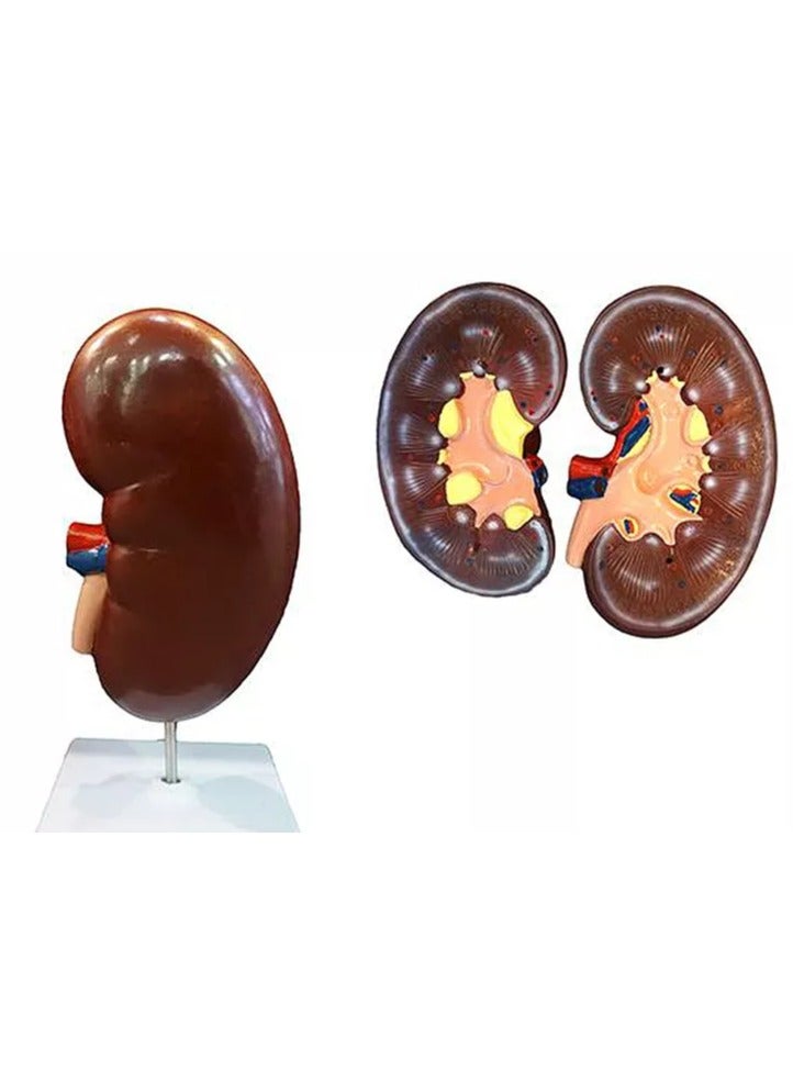 AKM meticulously detailed anatomical kidney model. Expertly crafted to provide a visual understanding of human renal anatomy - Image 3