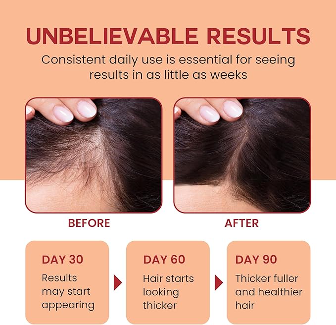 Lebanta Raw Batana Oil for Hair, 100% Pure Organic Cold Pressed Unrefined Batana Oil from Honduras for Thick, Strong Hair & Scalp Mask, 4 oz - Image 3