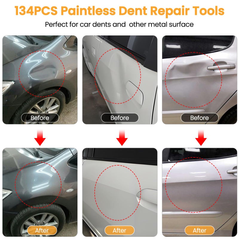 Sigoobal Dent Puller, 134PCS Paintless Dent Removal Kit â€“ Car Dent Puller Kit with Slide Hammer 2 in 1 T-Bar, Golden Lifter, Bridge Pullerâ€“Dent Remover Tool for Car Hail, Dings Damage DIY Repair - Image 2