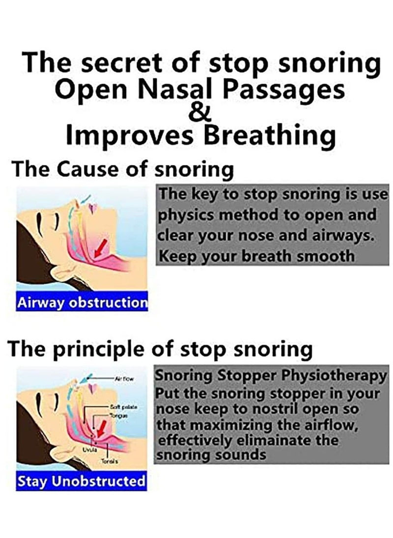 SYOSI - Anti Snoring Devices for Sleep Nose Clips Nasal Dilator Anti Snore Nose Clip Device Adjustable Solution Anti Snoring Aid Sleep Device Snore Stopper Stop Anti Snoring Device Solution - Image 1