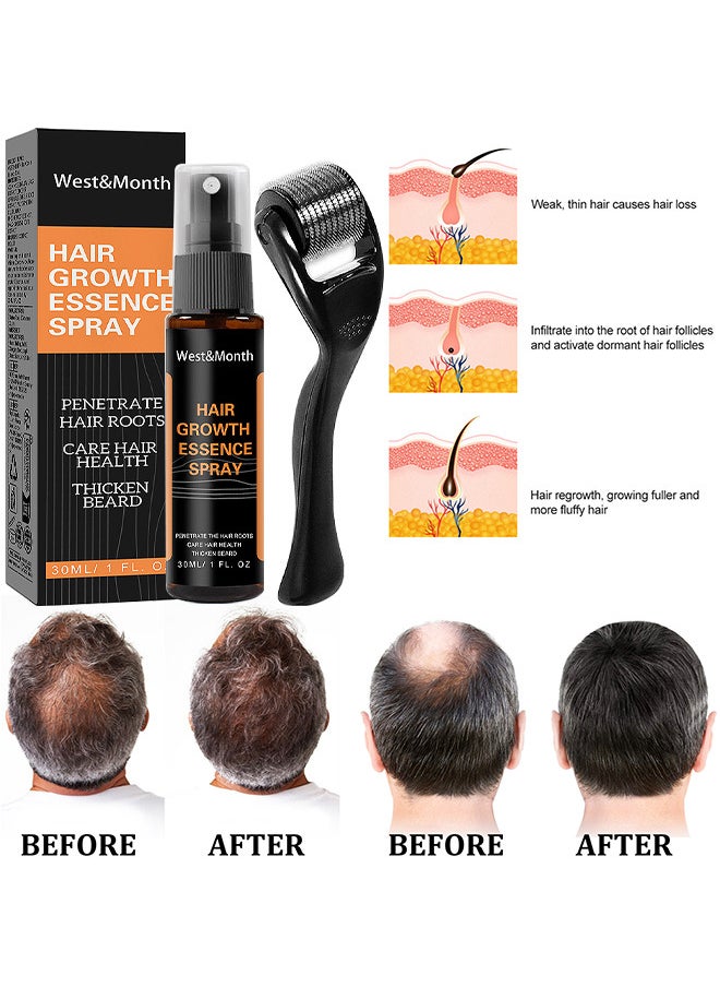 West&Month 30ML Hair Growth Essence Spray, Anti-Slip Hair Nourishing Growth Liquid Thickening Hairline Essence Spray With Microne Roller, Hair Loss And Thinning Prevention Treatment, Scalp Improver  - Image 5
