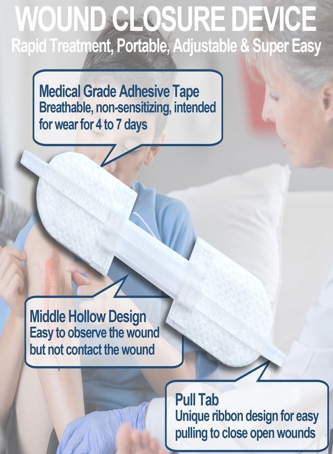 MediMatic Wound Closure Strips - Emergency Laceration Closure Kit to Repair 3 Individual/Combine Wounds Without Stitches, Butterfly Bandages for Wound Closure to Close, Cover Wounds - Quick Clot - Image 4