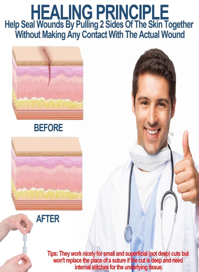 MediMatic Wound Closure Strips - Emergency Laceration Closure Kit to Repair 3 Individual/Combine Wounds Without Stitches, Butterfly Bandages for Wound Closure to Close, Cover Wounds - Quick Clot - Image 3