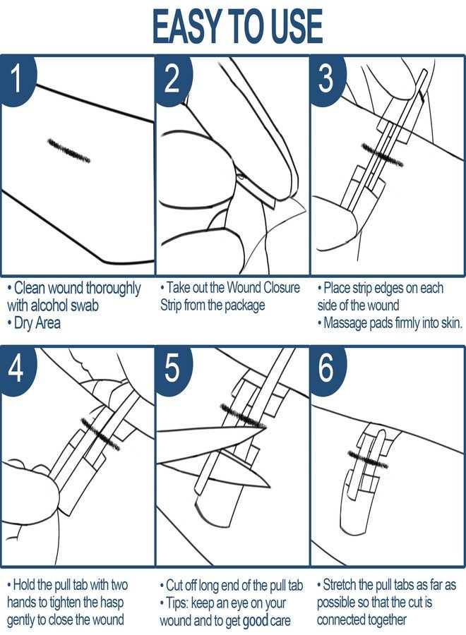 MediMatic Wound Closure Strips - Emergency Laceration Closure Kit to Repair 3 Individual/Combine Wounds Without Stitches, Butterfly Bandages for Wound Closure to Close, Cover Wounds - Quick Clot - Image 5