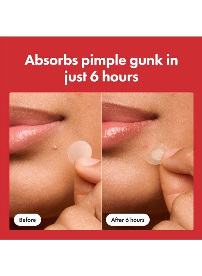 Hero The #1 Hydrocolloid Acne Pimple Patch for Shrinking Zits and Whiteheads in 1 use; Nighttime Spot Stickers for Face and Skin (72 Count) - Image 4