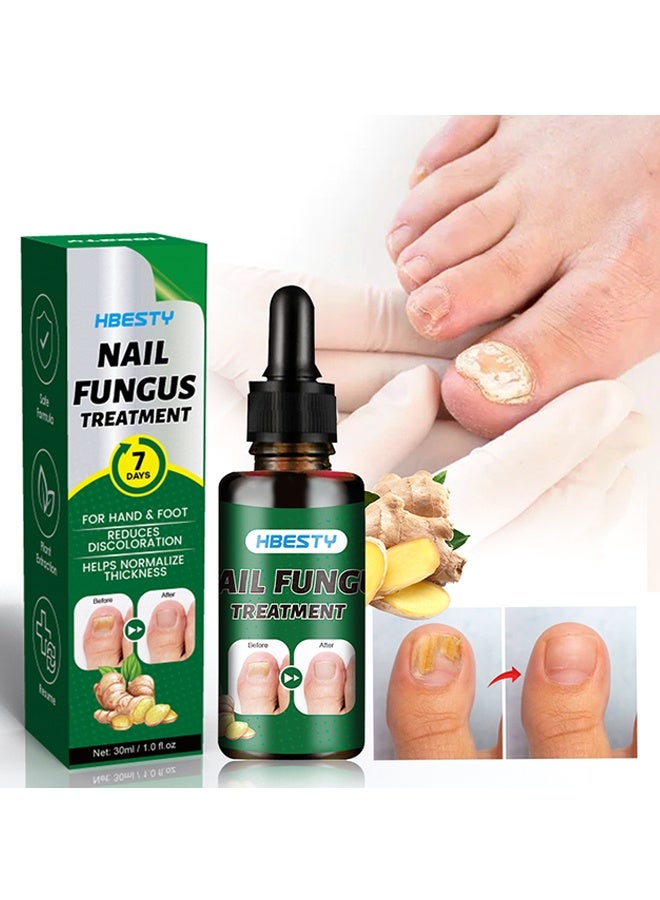 HBESTY 7 Days Nail Fungus Treatment, Moisturize the Cuticle & Strengthen Nails and Helps Nails Healthy Grow Nail Repair Treatment Solution Restoring Healthy Nails 30ml - Image 1